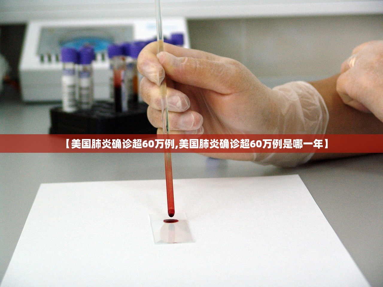 【美国肺炎确诊超60万例,美国肺炎确诊超60万例是哪一年】
