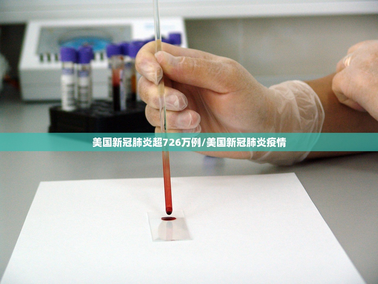 美国新冠肺炎超726万例/美国新冠肺炎疫情