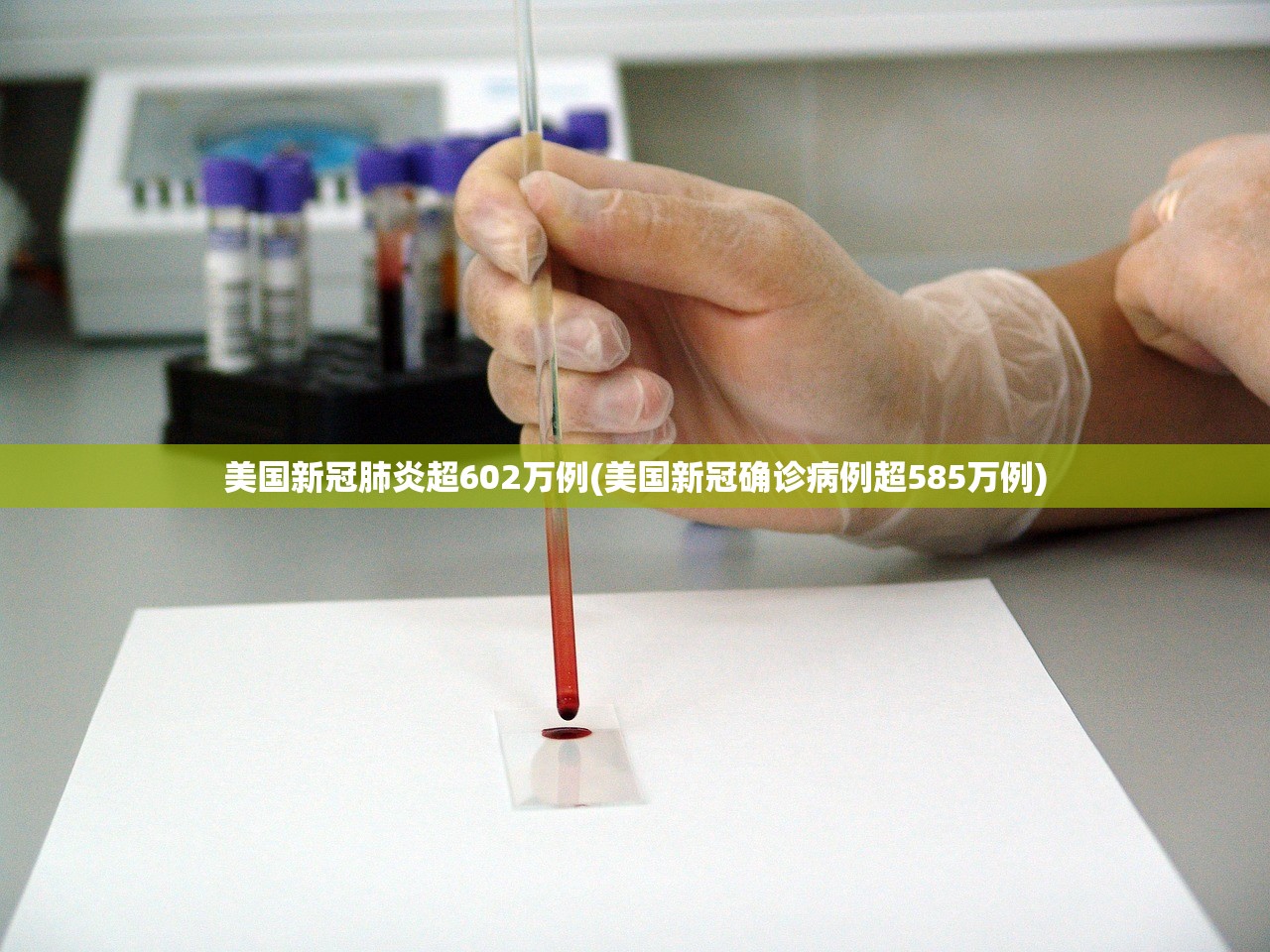 美国新冠肺炎超602万例(美国新冠确诊病例超585万例)