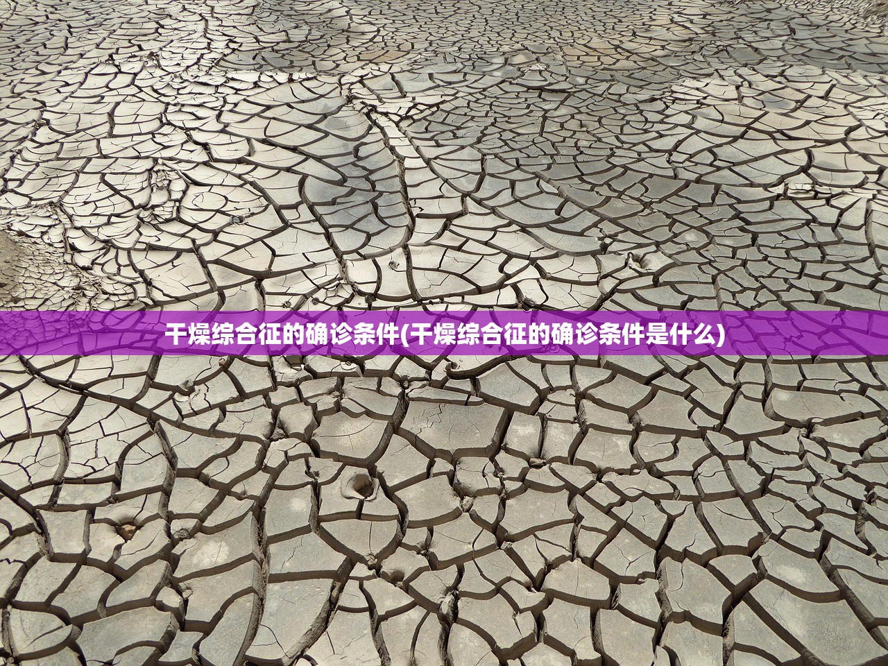 干燥综合征的确诊条件(干燥综合征的确诊条件是什么) 干燥综合征的确诊条件(干燥综合征的确诊条件是什么)