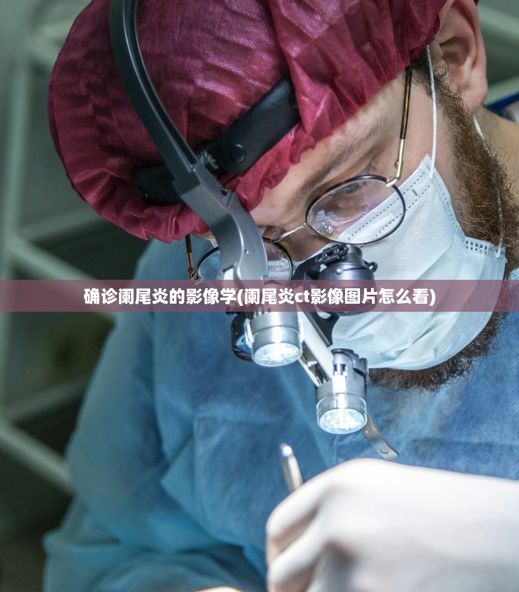 确诊阑尾炎的影像学(阑尾炎ct影像图片怎么看)