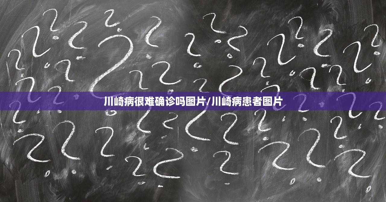 川崎病很难确诊吗图片/川崎病患者图片