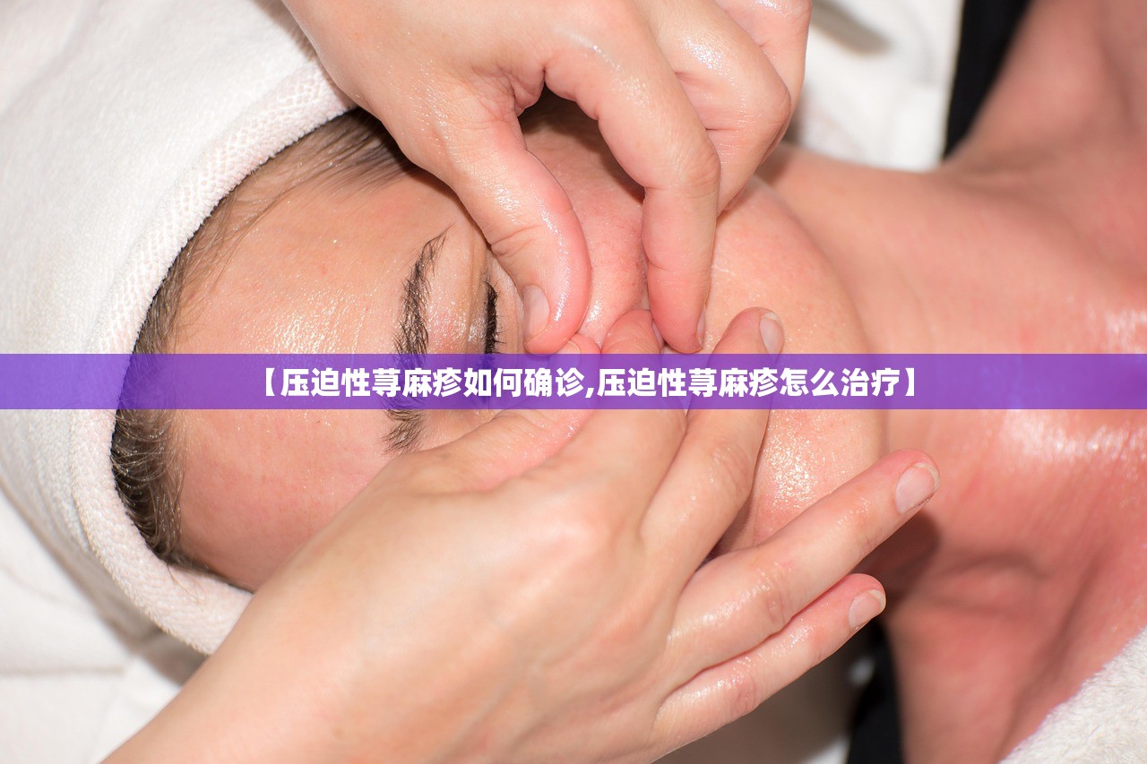 【压迫性荨麻疹如何确诊,压迫性荨麻疹怎么治疗】 【压迫性荨麻疹如何确诊,压迫性荨麻疹怎么治疗】