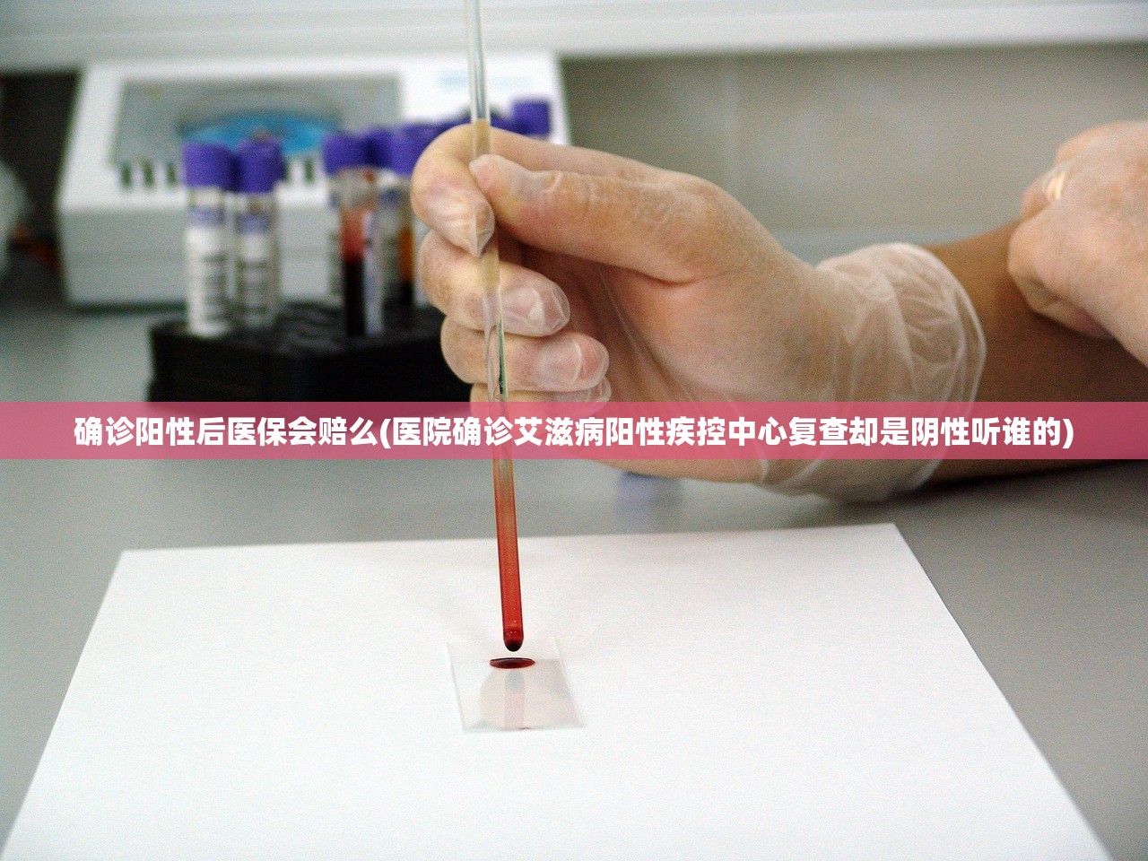 确诊阳性后医保会赔么(医院确诊艾滋病阳性疾控中心复查却是阴性听谁的) 确诊阳性后医保会赔么(医院确诊艾滋病阳性疾控中心复查却是阴性听谁的)
