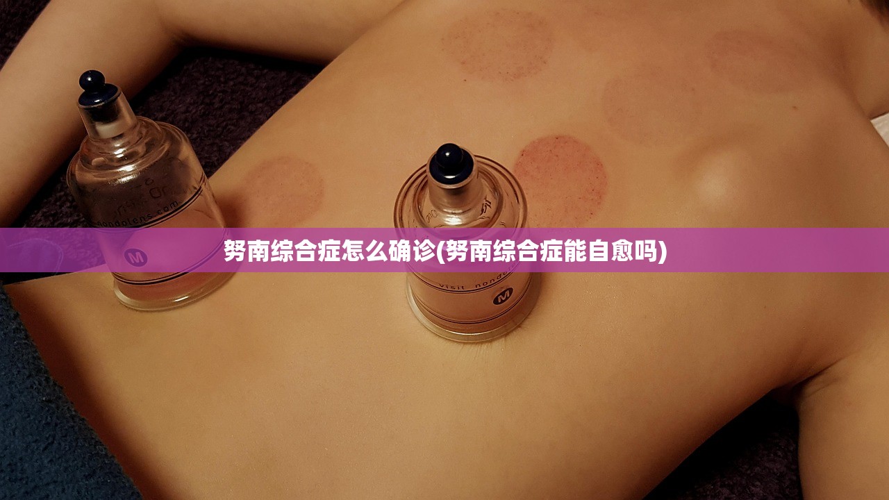 努南综合症怎么确诊(努南综合症能自愈吗)